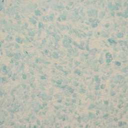 Жидкие обои Silk Plaster Рельеф 321 Жидкие обои Silk Plaster Рельеф 321