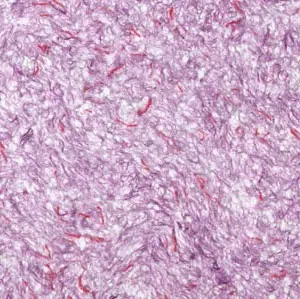   Bioplast  4 611 -  1