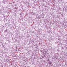   Bioplast  4 611