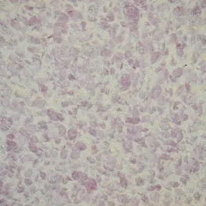   Silk Plaster   331 -  1